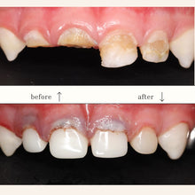 Load image into Gallery viewer, Shinhung Kids Zirconia Crown Kit
