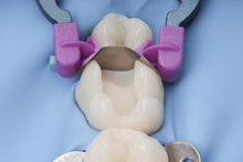 Load image into Gallery viewer, Polydentia myQuickmat Forte Starter Kit