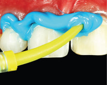 Load image into Gallery viewer, Zhermack Elite HD+ Light Body