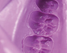 Load image into Gallery viewer, Zhermack Hydrogum 5