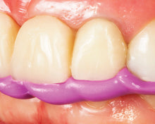 Load image into Gallery viewer, Zhermack Occlufast Rock